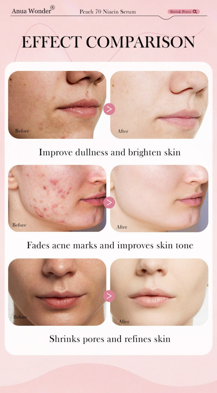 ANUA Peach 70 Niacinamide Serum